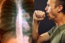 lung cancer symptoms signs cough treatment causes