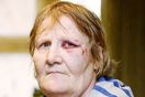 Nottingham grandmother attack latest St anns well road