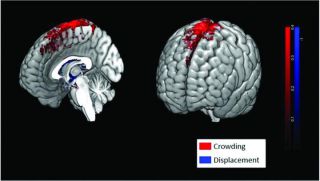 Long Space Missions Can Change Astronaut Brain Structure and Function – Space.com