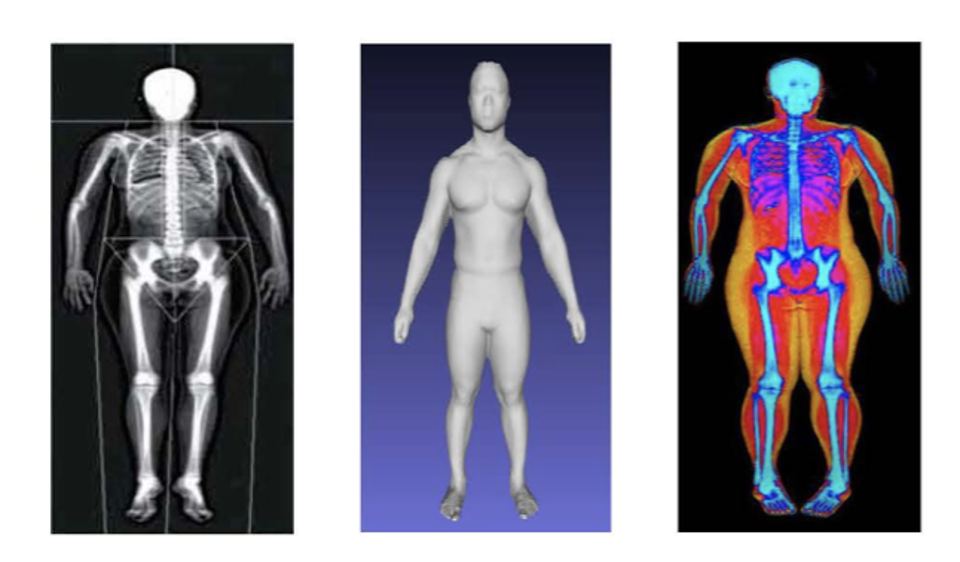 3D optical images are analyzed with AI to measure body composition including fat, lean, and bone mass.