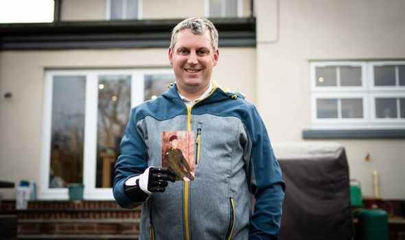 bionic arm war veteran military GMB 3d printing nhs prosthetic limb