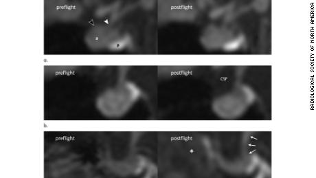 These are examples of changes in astronauts&#39; pituitary glands after spaceflight.