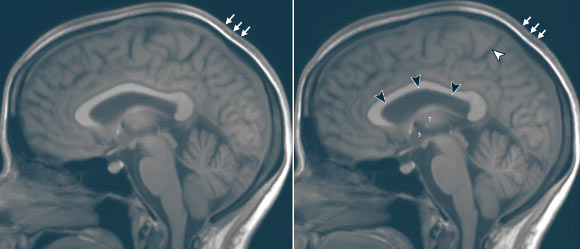 Study: Long-Duration Spaceflight Affects Brain Volume | Neuroscience, Space Exploration – Sci-News.com